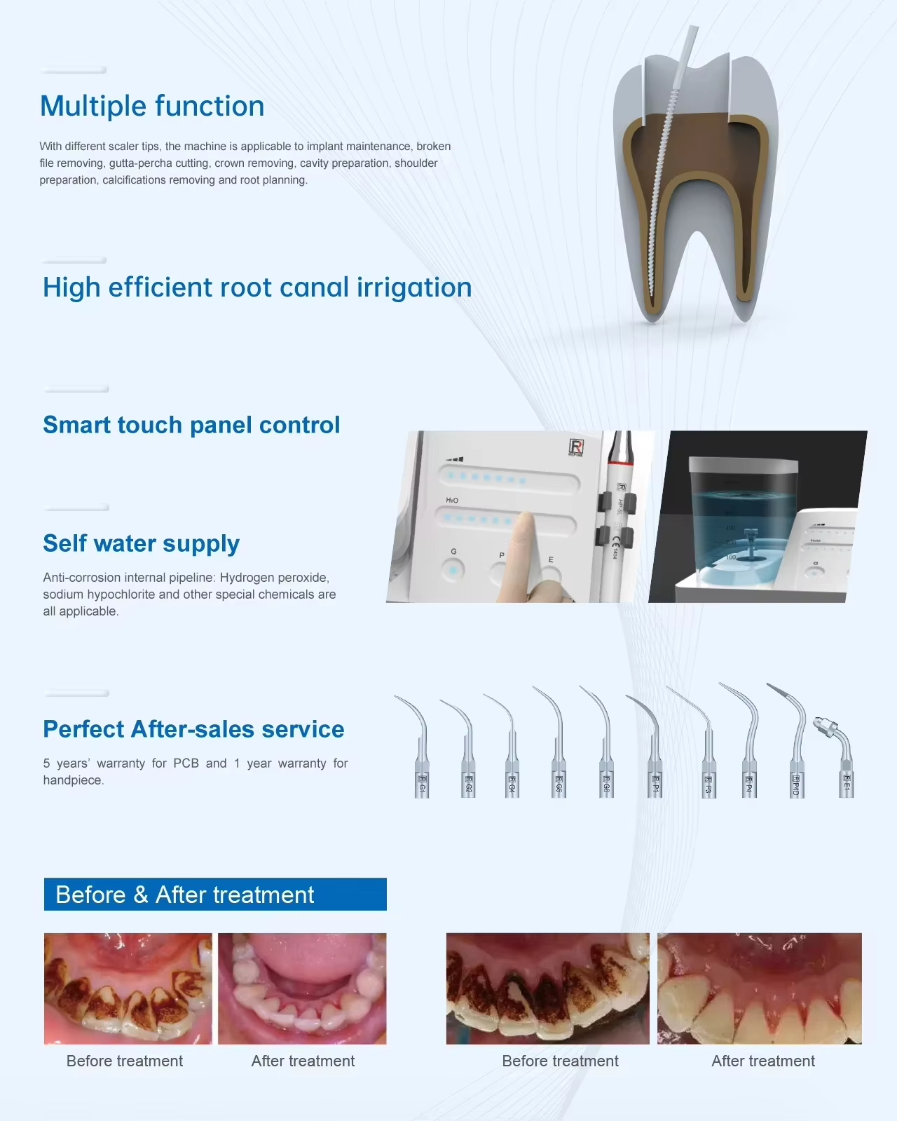 Oral Hygiene Portable LED Toot - огляд і ціна Dental Scaler Ultrasonic